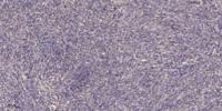 SCCA2 Polyclonal Antibody