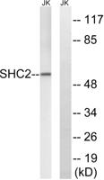 Sck Polyclonal Antibody