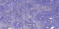 SCML2 Polyclonal Antibody