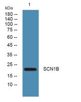 SCN1B Polyclonal Antibody