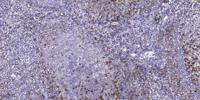 Scn4b Polyclonal Antibody