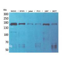 SCP-2 Polyclonal Antibody