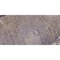 SCP-2 Polyclonal Antibody