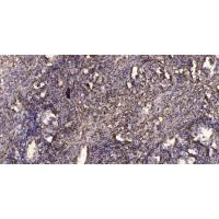 SCP-3 Polyclonal Antibody