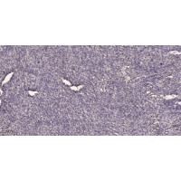 SCYL1BP1 Polyclonal Antibody