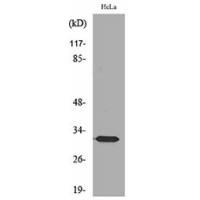 SDHB Polyclonal Antibody