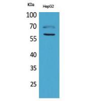 HEXA Polyclonal Antibody