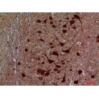 HEXA Polyclonal Antibody