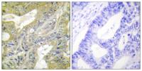 Hexb Polyclonal Antibody