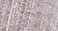 Hexim1 Polyclonal Antibody