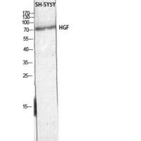 HGF Polyclonal Antibody