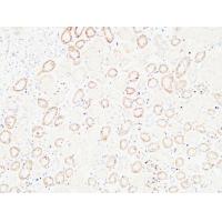 HGF Polyclonal Antibody