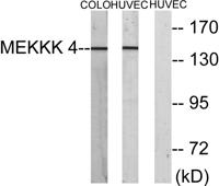 HGK Polyclonal Antibody