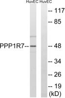 Sds22 Polyclonal Antibody