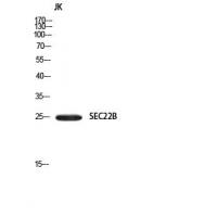 SEC22B Polyclonal Antibody