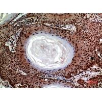 SEC22B Polyclonal Antibody