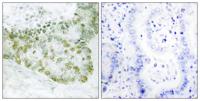 Hic-5 Polyclonal Antibody