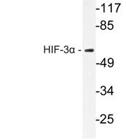 HIF-3α Polyclonal Antibody
