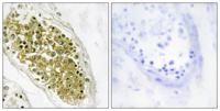 HIPK4 Polyclonal Antibody