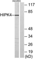 HIPK4 Polyclonal Antibody