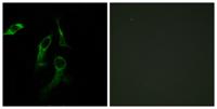 HisRS Polyclonal Antibody