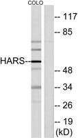 HisRS Polyclonal Antibody