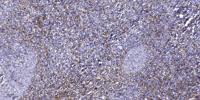 HisRS Polyclonal Antibody