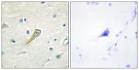 SEMA4A Polyclonal Antibody