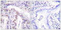SENP6 Polyclonal Antibody