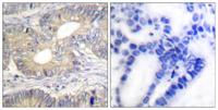 Somatostatin Polyclonal Antibody