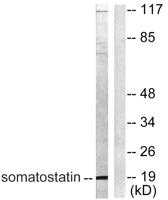Somatostatin Polyclonal Antibody