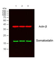 Somatostatin Polyclonal Antibody