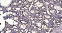 Sox-17 Polyclonal Antibody