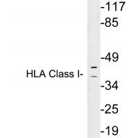 HLA Class I Polyclonal Antibody