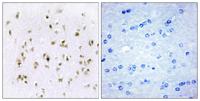 HMG-17 Polyclonal Antibody
