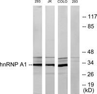 hnRNP A1 Polyclonal Antibody