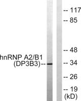 hnRNP A2/B1 Polyclonal Antibody