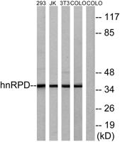 hnRNP D0 Polyclonal Antibody