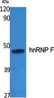 hnRNP F Polyclonal Antibody