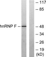 hnRNP F Polyclonal Antibody