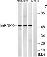 hnRNP K Polyclonal Antibody