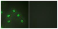 hnRNP L Polyclonal Antibody