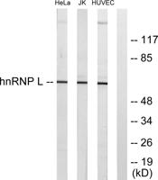 hnRNP L Polyclonal Antibody