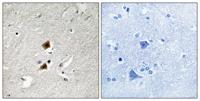 hnRNP LL Polyclonal Antibody