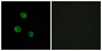 hnRNP M Polyclonal Antibody