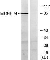 hnRNP M Polyclonal Antibody