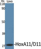 HoxA11/D11 Polyclonal Antibody