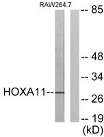 HoxA11/D11 Polyclonal Antibody