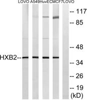 HoxB2 Polyclonal Antibody