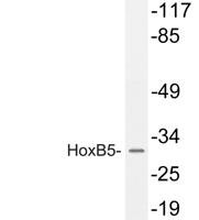 HoxB5 Polyclonal Antibody